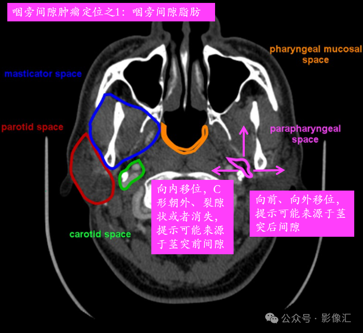9ec613c6de609460d7598e09a1b7c30c.png
