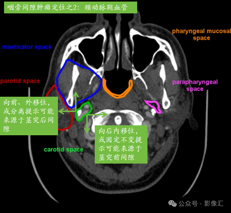 09df6a4fda035ba5ed9b34c2cf936d19.png