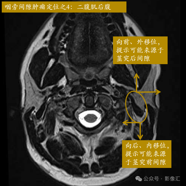 15a0927a57d8c6a406f912b90874001c.png
