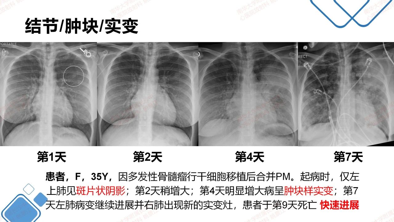 d1b4ff5dfff1149f454de961331c8d38.jpg
