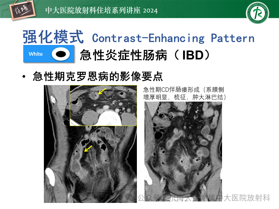 d35ebea98e6491414560073704a13e00.png