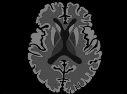 202a072e93be762c119142b3103c2f43.png