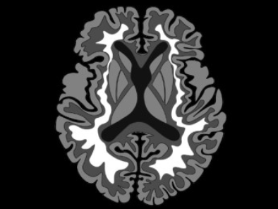 49c66a57dc8b3c224336358f36f37cb1.png