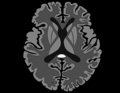 0ec29a30587c41d52fa59786c78be549.png