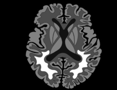 bb604c5911c8a7b88ef8ca29b0ffbc52.png