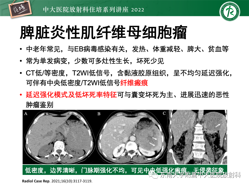 31485ebc935f2eded4d9964af2ad0d70.png