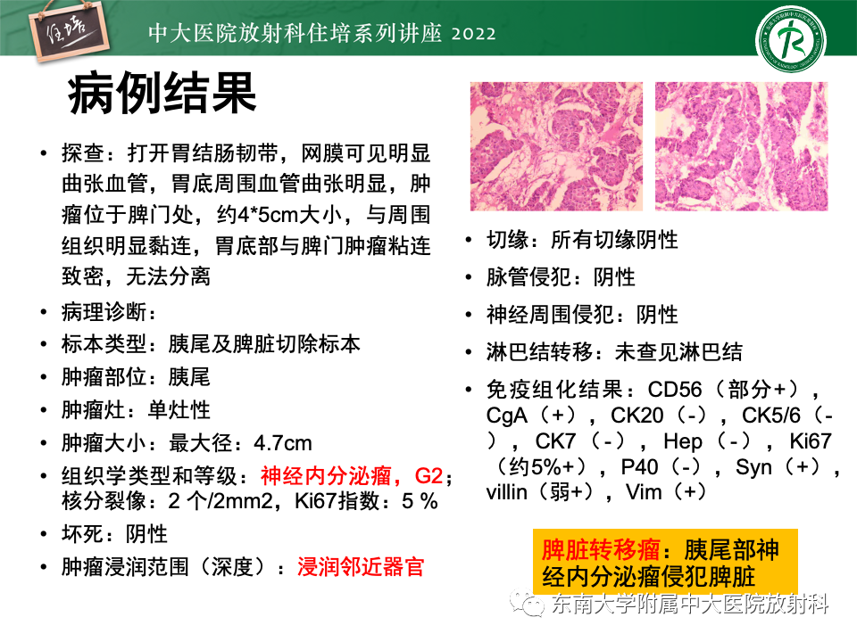 b36ec50c26cfc26e88076392db55449e.png