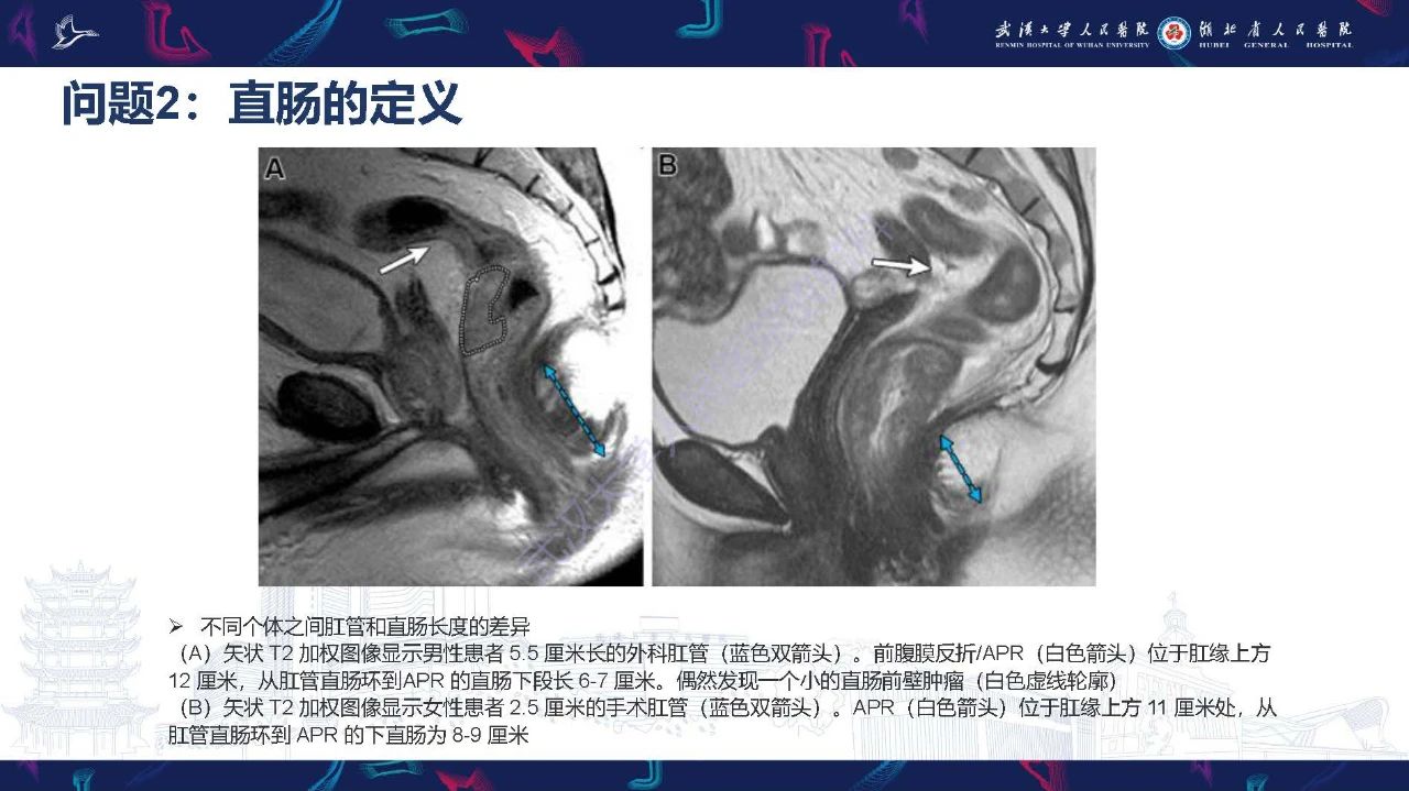 d98c988717046a64e436d5de29634dbb.jpg