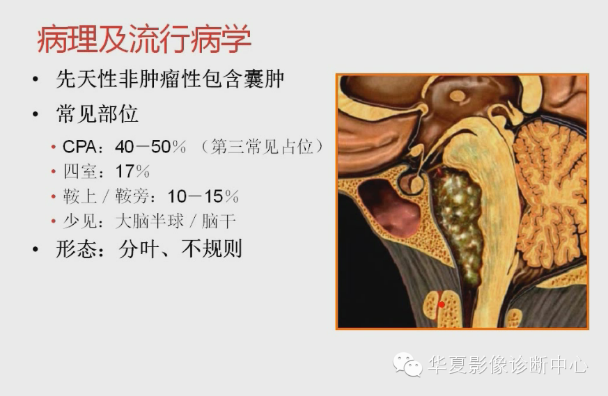 e54842a7a82e0ecba8773ce814848f4f.png