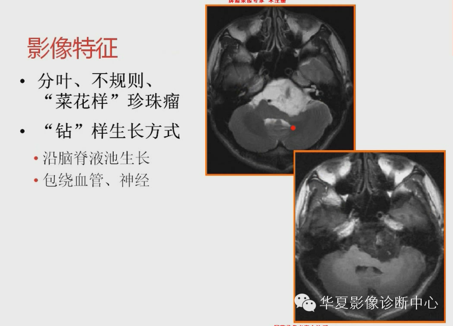 455fdad33b026a2045d259ec75f955a5.png