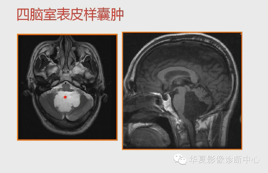 cd62851617bfc5eeda86154ee0e22879.png