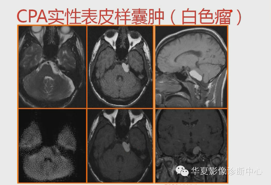 8ec3f079d31f2866b9e091f5b5544c2e.png
