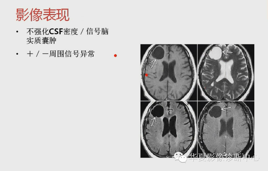 d88b28d51628cb1bc8cf7544be0547d8.png