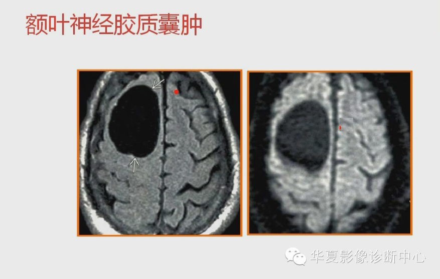 ad82b6bdfc33d1c91cb97977017d49ae.png