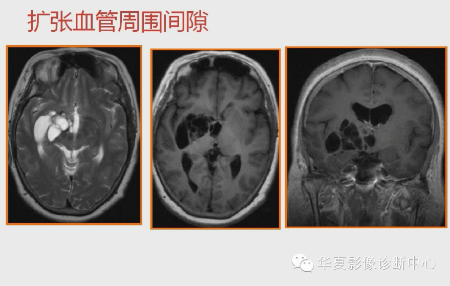 51a5d402013e4aef96849deead99615c.png