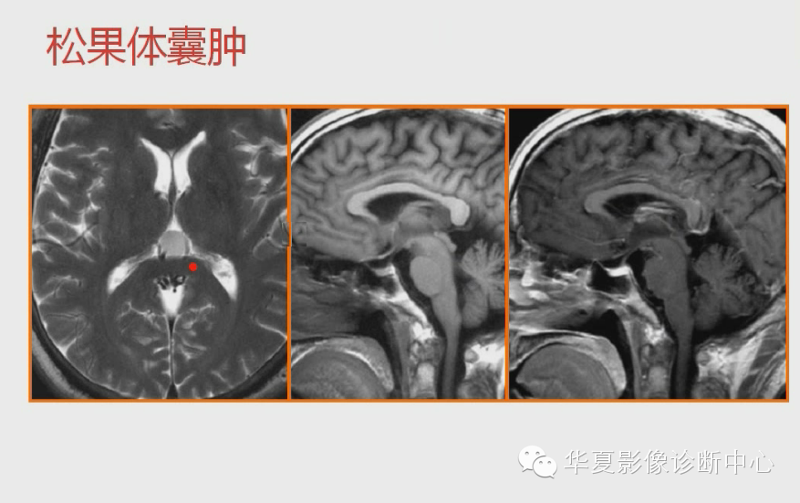 c887bc882efbd275e8fae0f28bfe8a0e.png