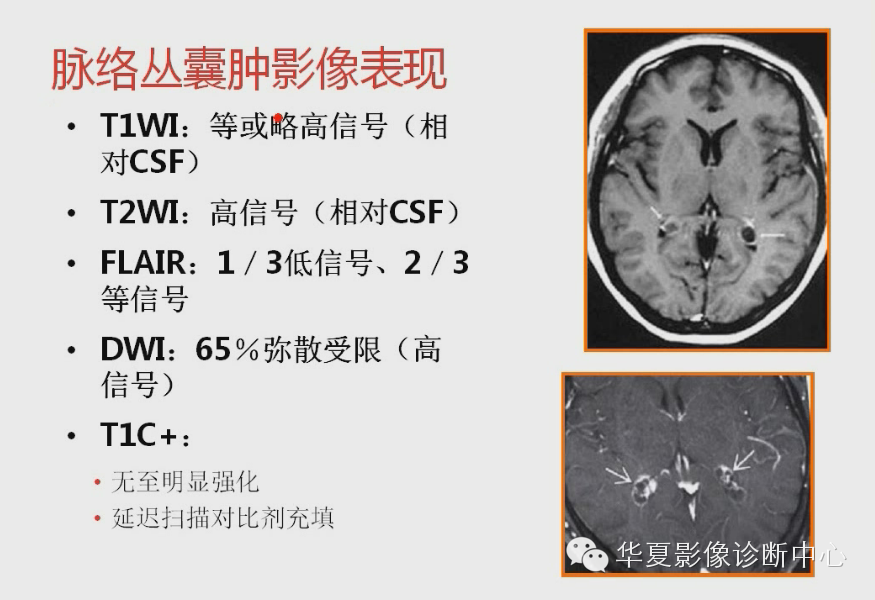 8c6bcd9878cba9d7790d505ec14b76fc.png