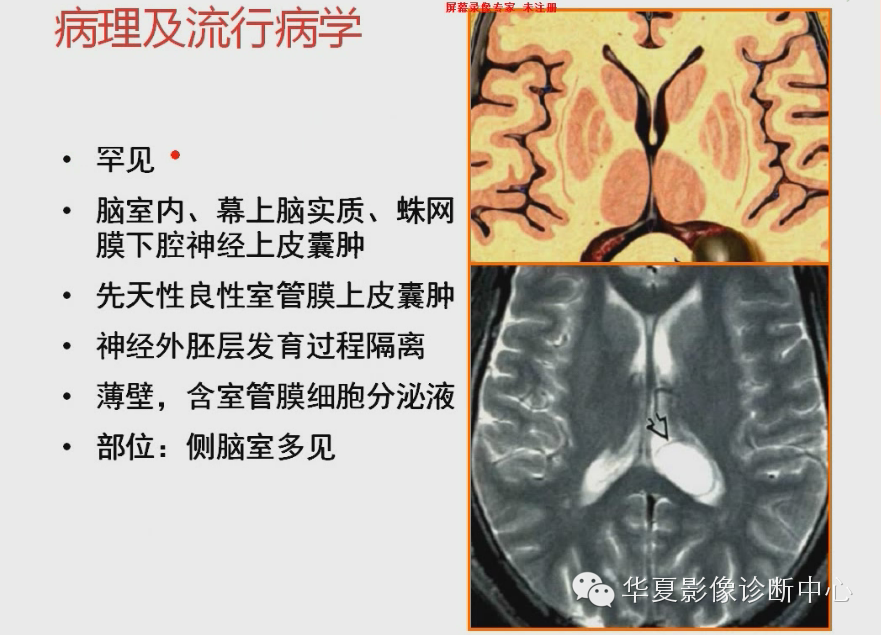 4390eded1468698208b1e966f2ee964b.png