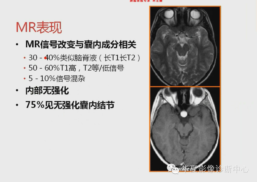 b70648342f6c14574c17ffe2345d6e33.png