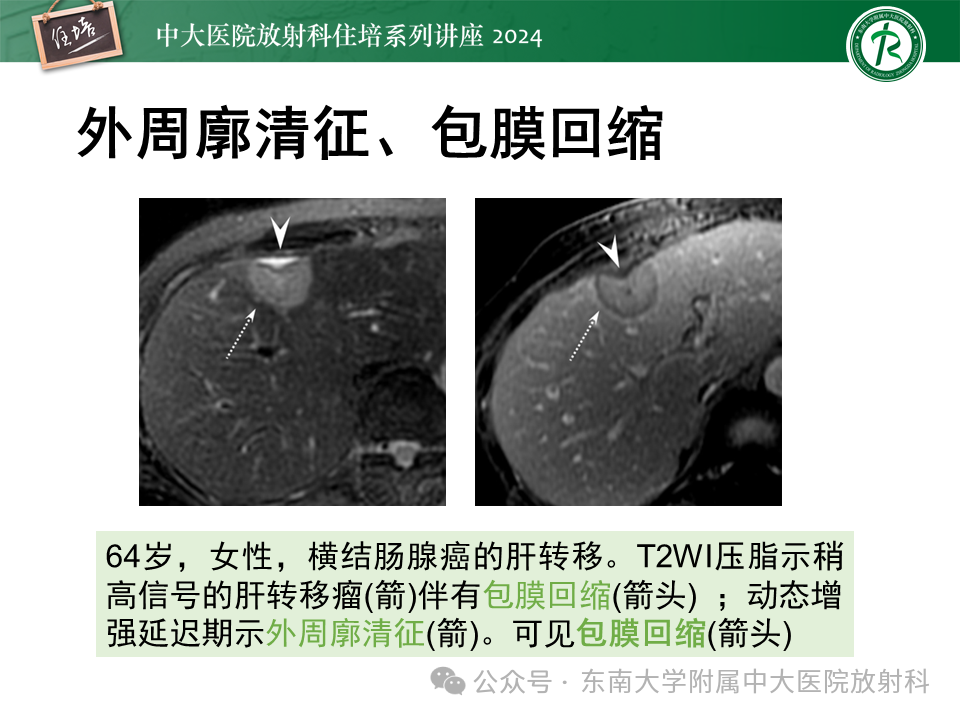 2a8a318ae204131092f049f88e81e86e.png