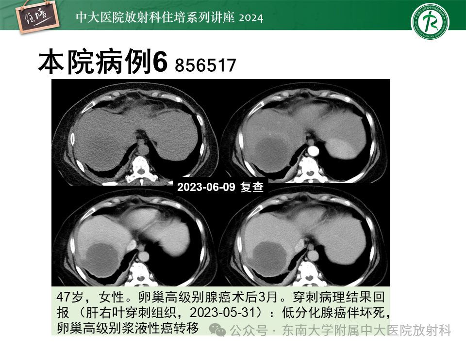e7142a35cf1b5cffe66709eb86f6cf06.png