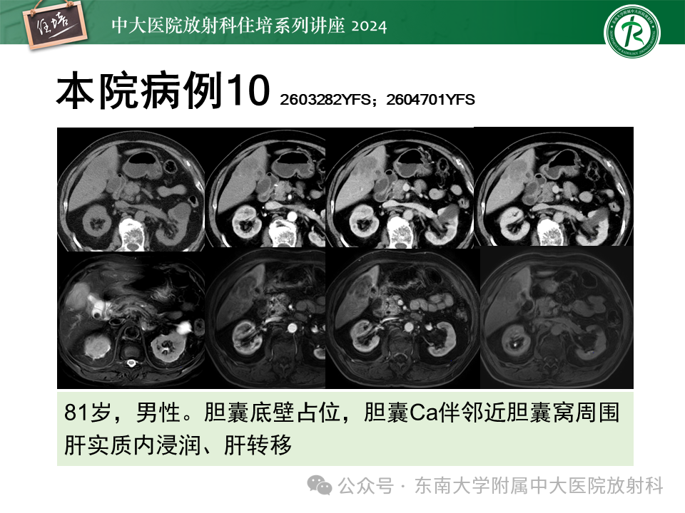 7c030cc847b1c883bb9dc634fca6f2bb.png