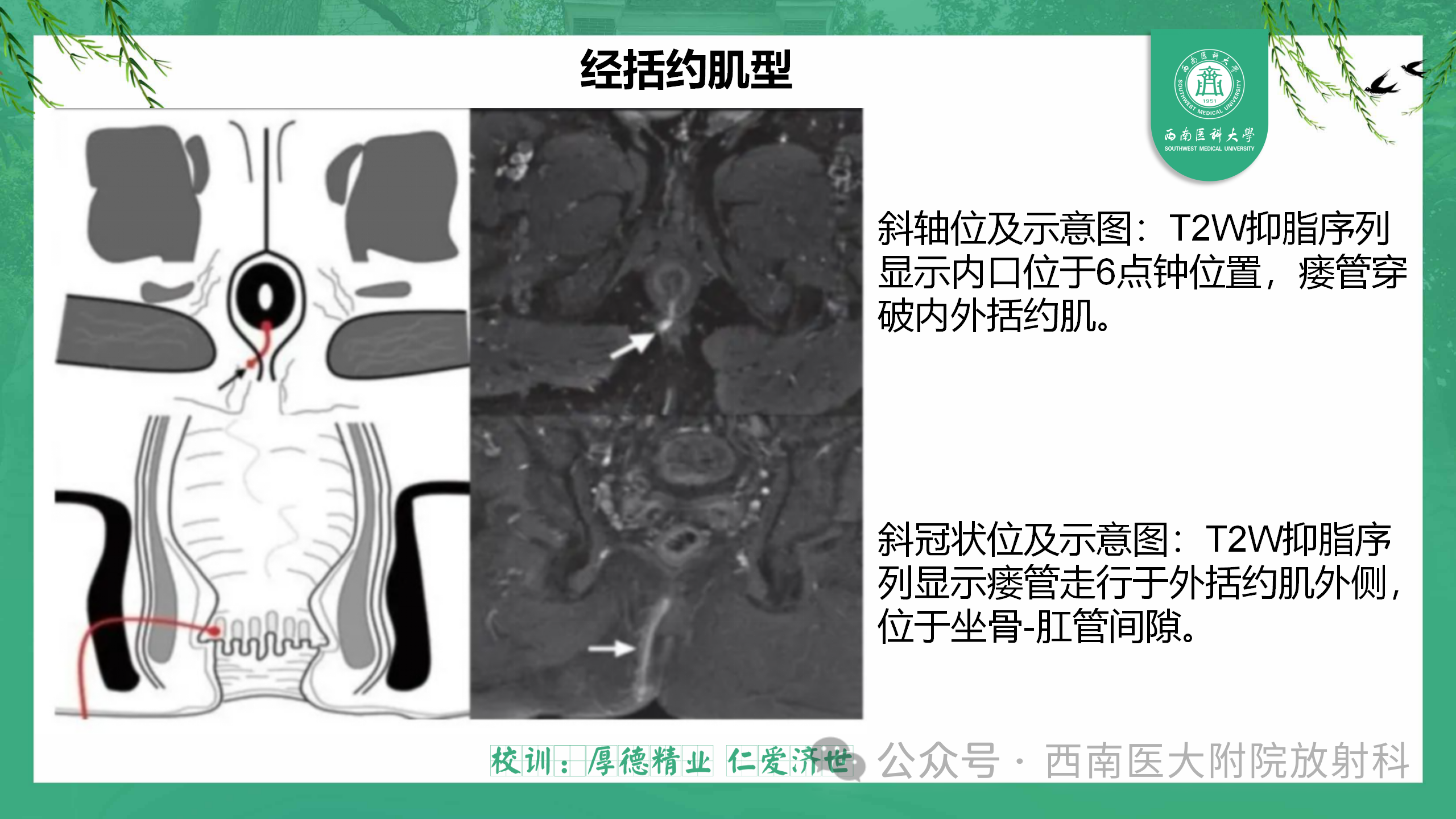 10e26b53bf650cdb87d272f8394f7233.png