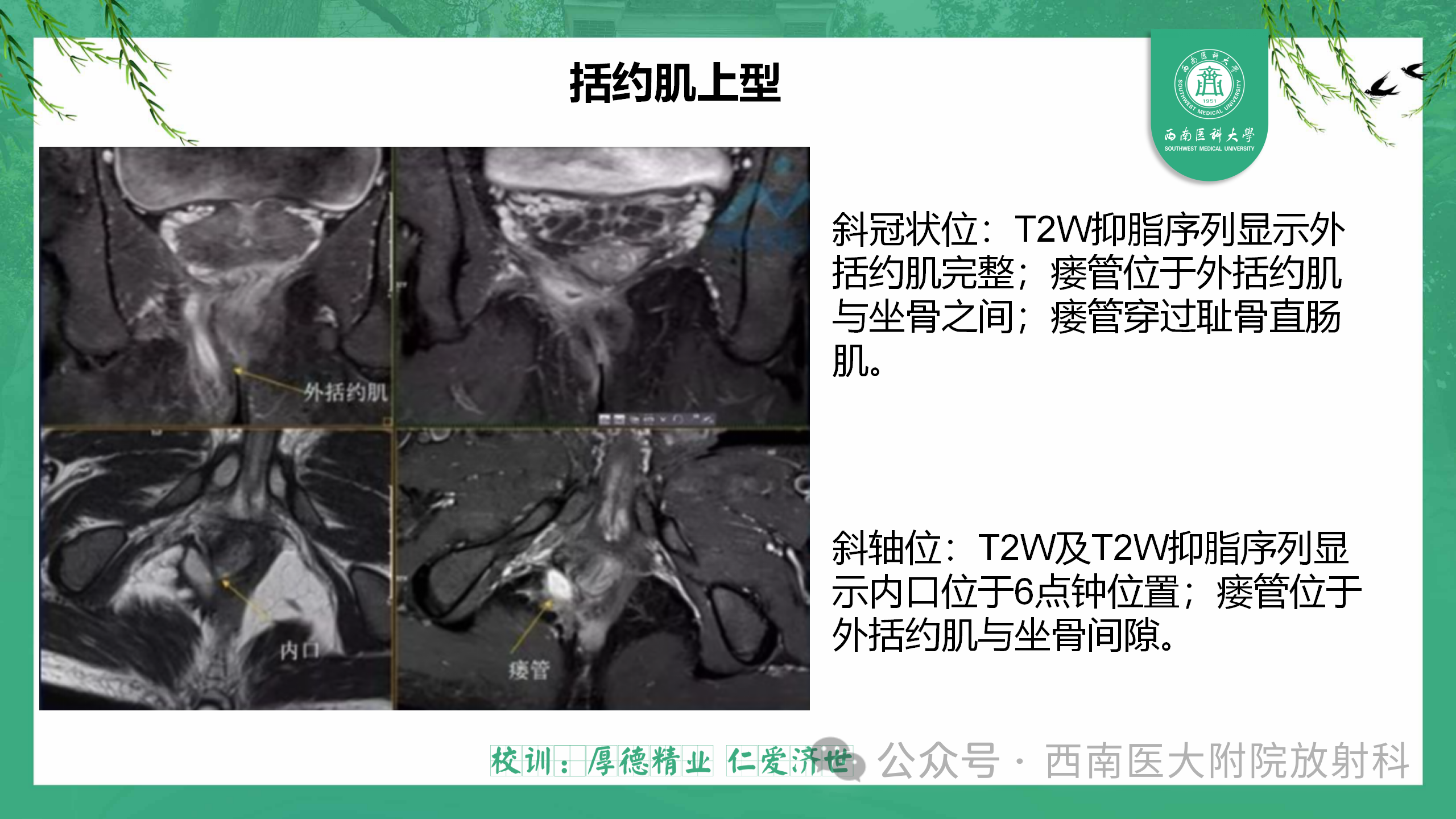 d4699f60ba139ccd589a431deb5a5159.png