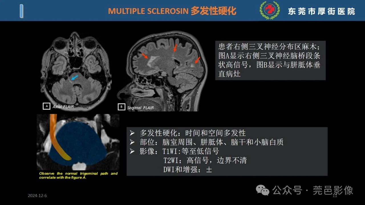 a24fd5e9db11a56d49cd00203a7c56d5.jpg