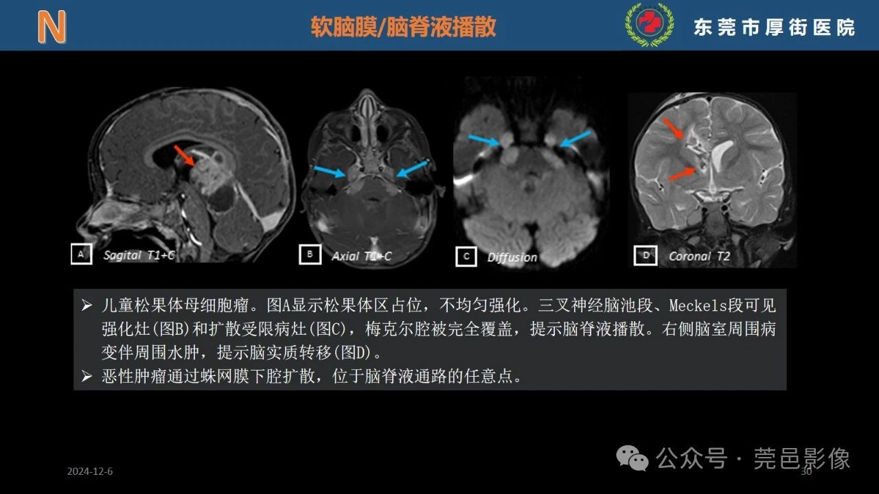 f70b9281a560c233b2da2b323d72aacb.jpg