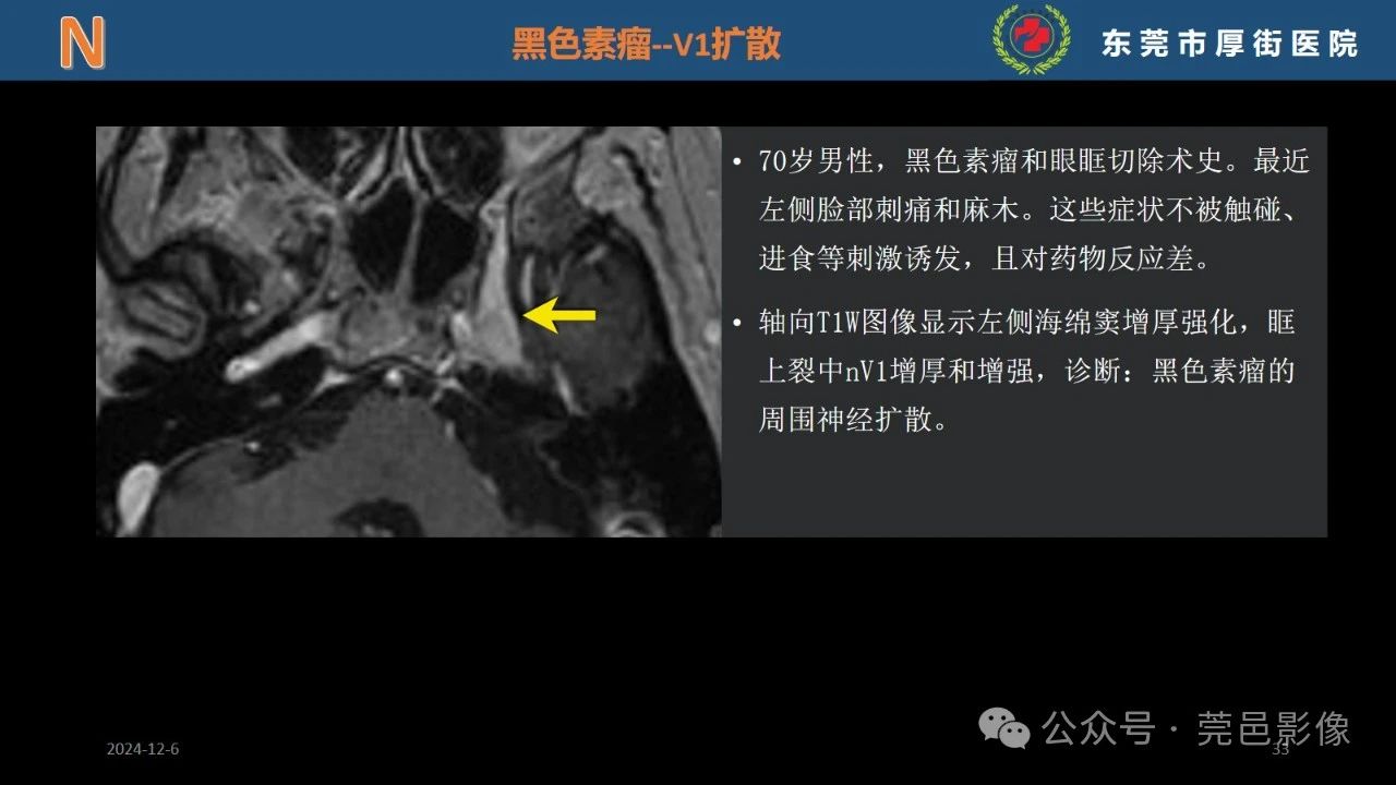 afc8460263cad73a907f723370dc252f.jpg