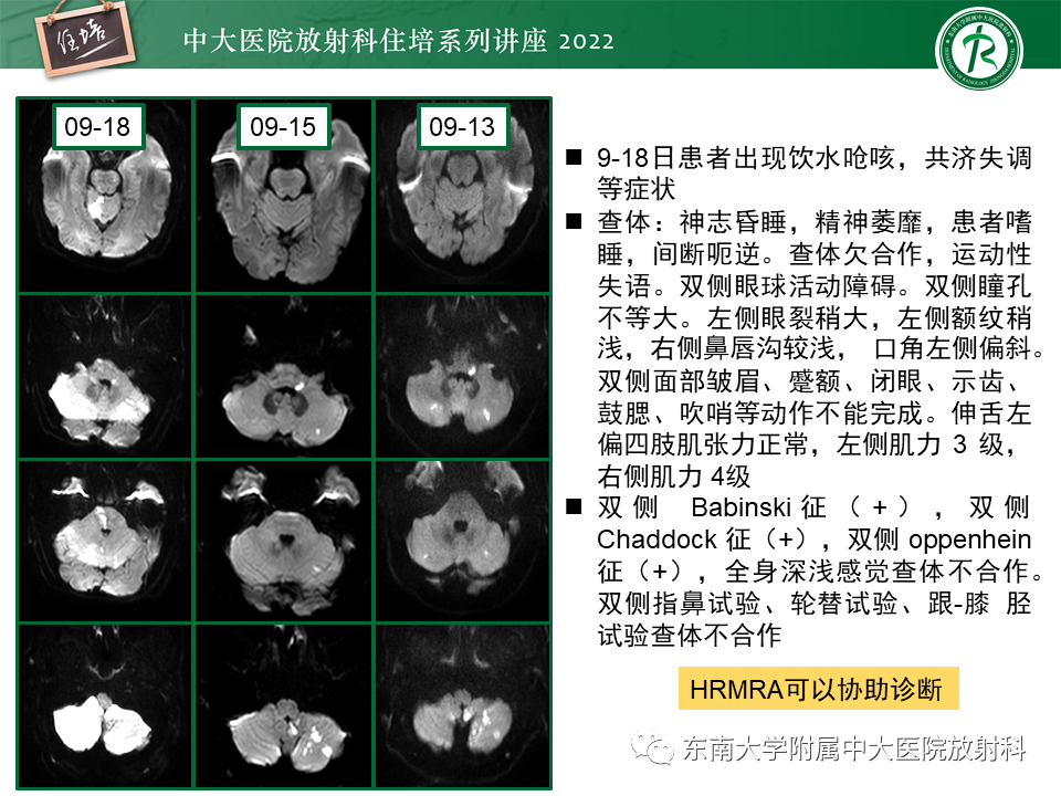 ee14b7338afa0e8a8f334e3a16139cd0.png