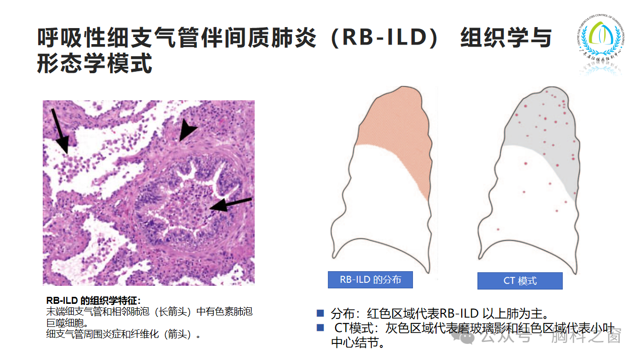 2ccddc1ca74e02f7345ba58a7a0cfb8a.png