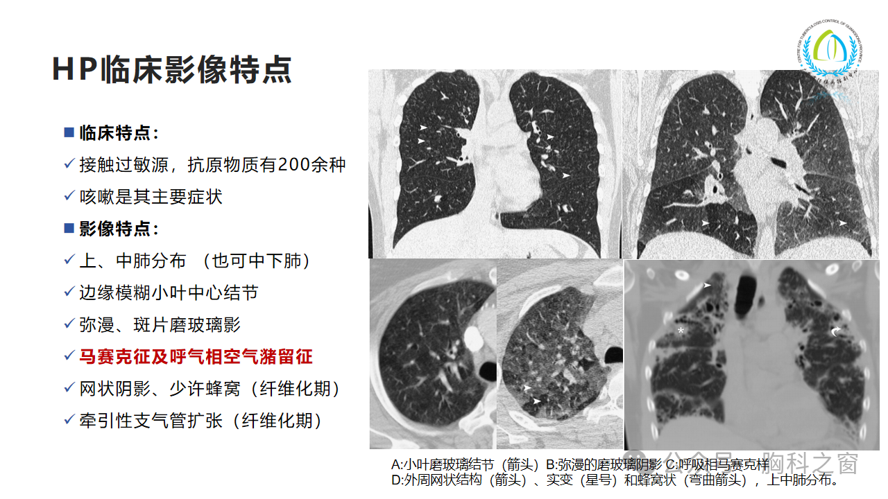 1fc8591dc5694e835bd9ecca53aa1b5f.png