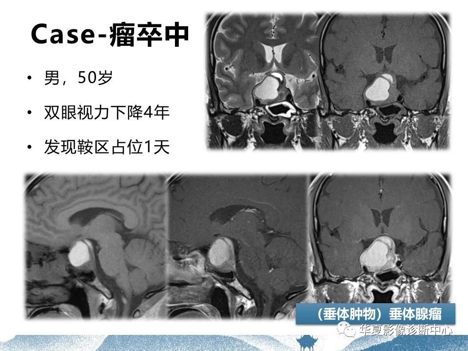 acb8ef251cdaff11f490971d61949d42.jpg