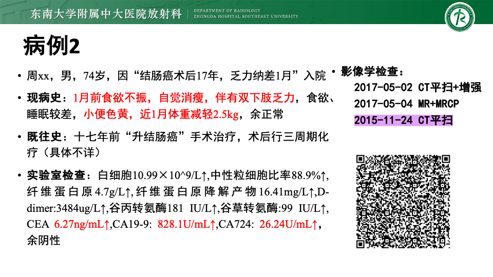 54dbe93c92cc3dcb3674851e3b315716.png
