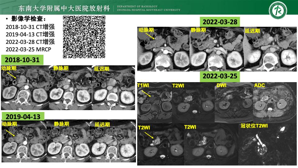 b1f2adc261a59687a7c1d247d96fcc98.png