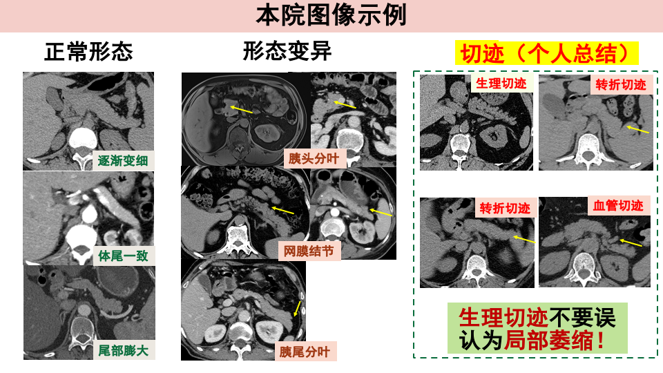 74e006d5f7f906b2f9d3193894c583e3.png