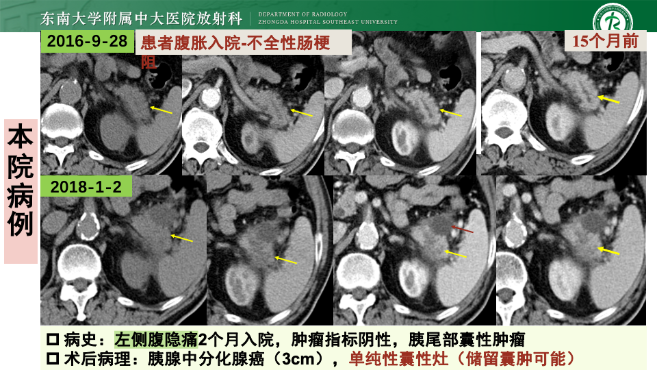 ace181a3a9978164d86a85cce4c4bc73.png