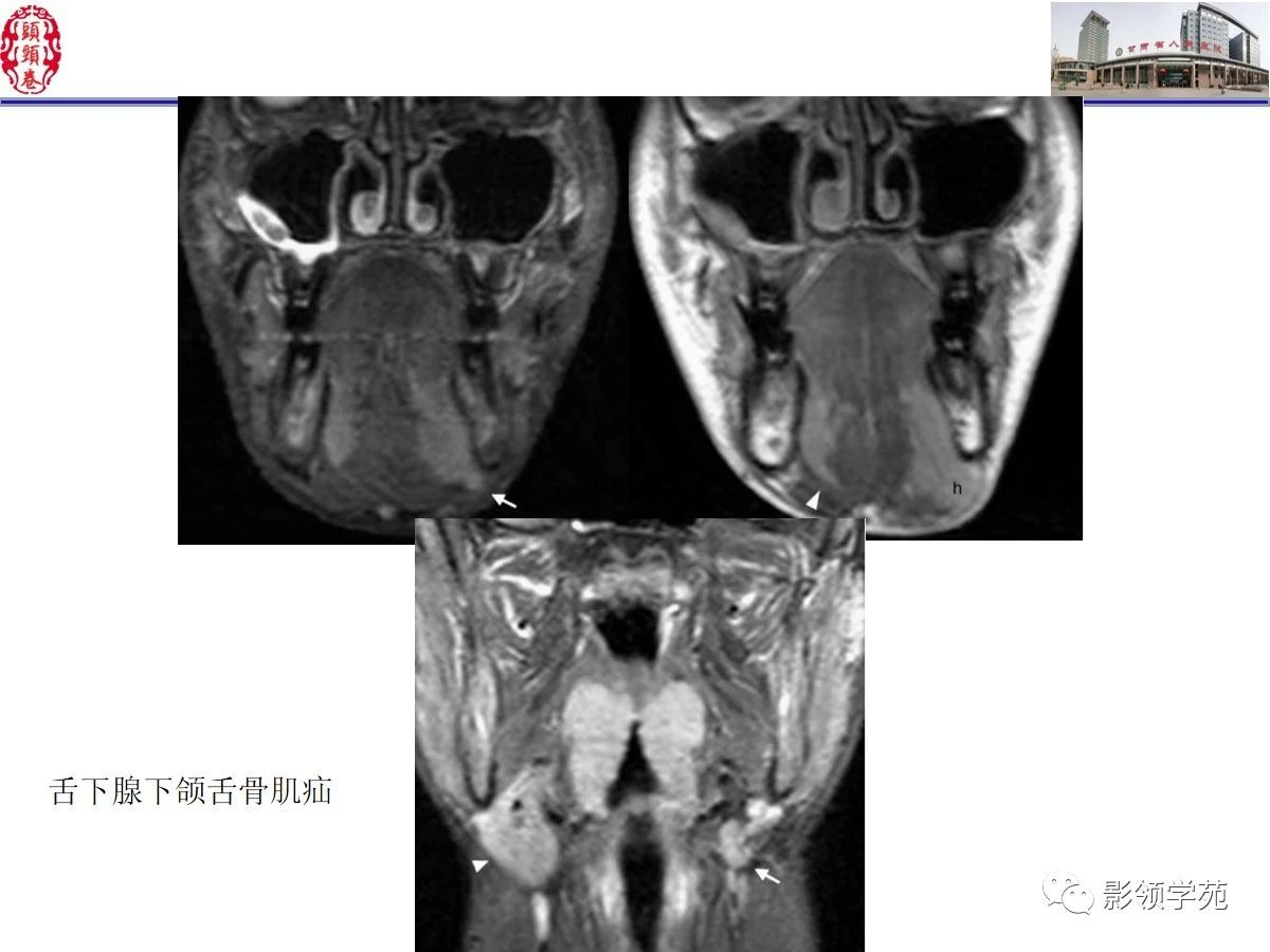 4d377031550d7e0c154f96fe922479c3.jpg