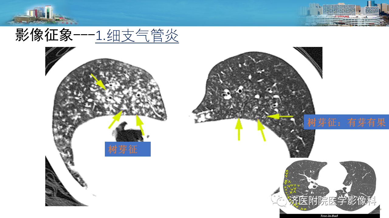 43fa28b2c62f3e130934443b9d4d6158.png