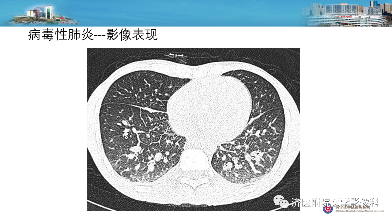 bee3313770bf0c2950430dfb9a43dc27.png