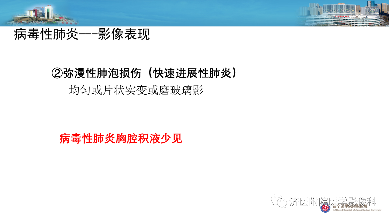 48e46cf9e1d2dec1000169524cd14366.png