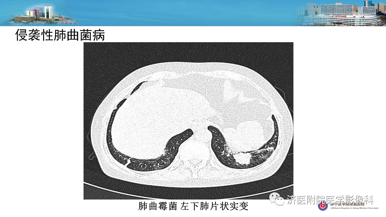 c44bf588efd944648654ffd7ff7045ce.png