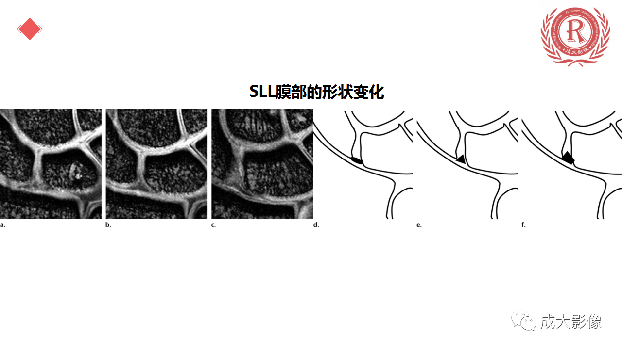 c111d9715ca017ab8f5ba1caade1d921.png