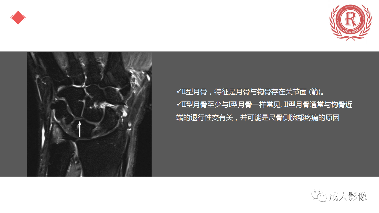 bf2278487cb81f0883987fa366194515.png