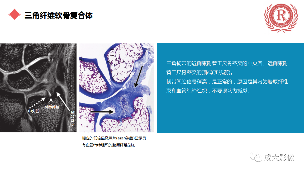 05c02bd8ed0cd319302458ebe13a3939.png