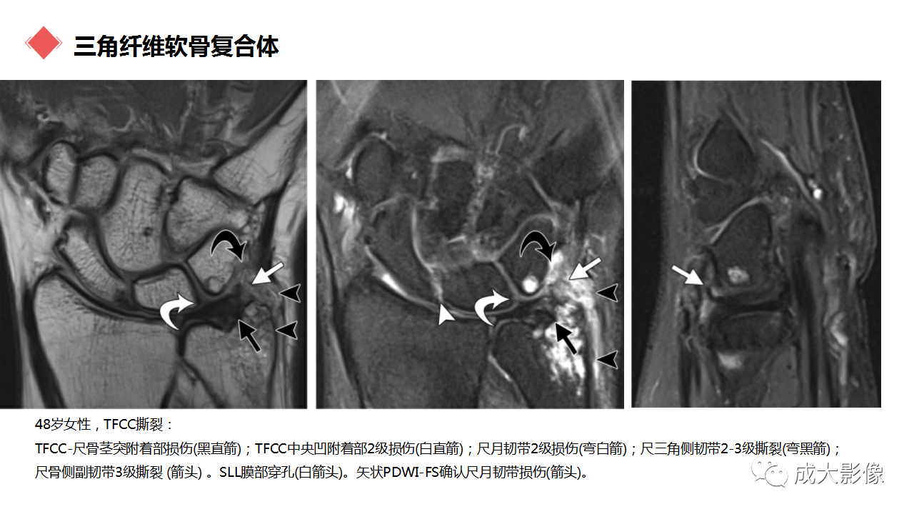 88bfe492a93224a27932e66cf713ad6d.png