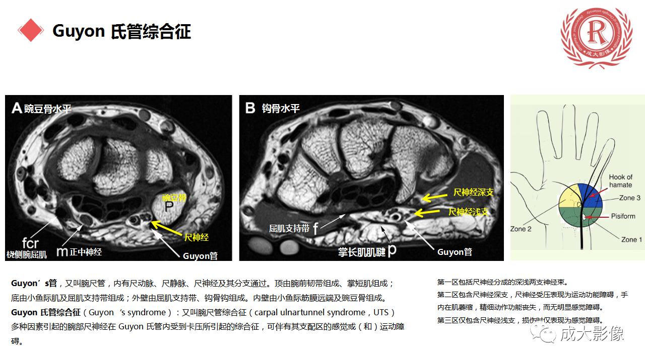 6719cff71214e3f96b643f9e444de59f.png