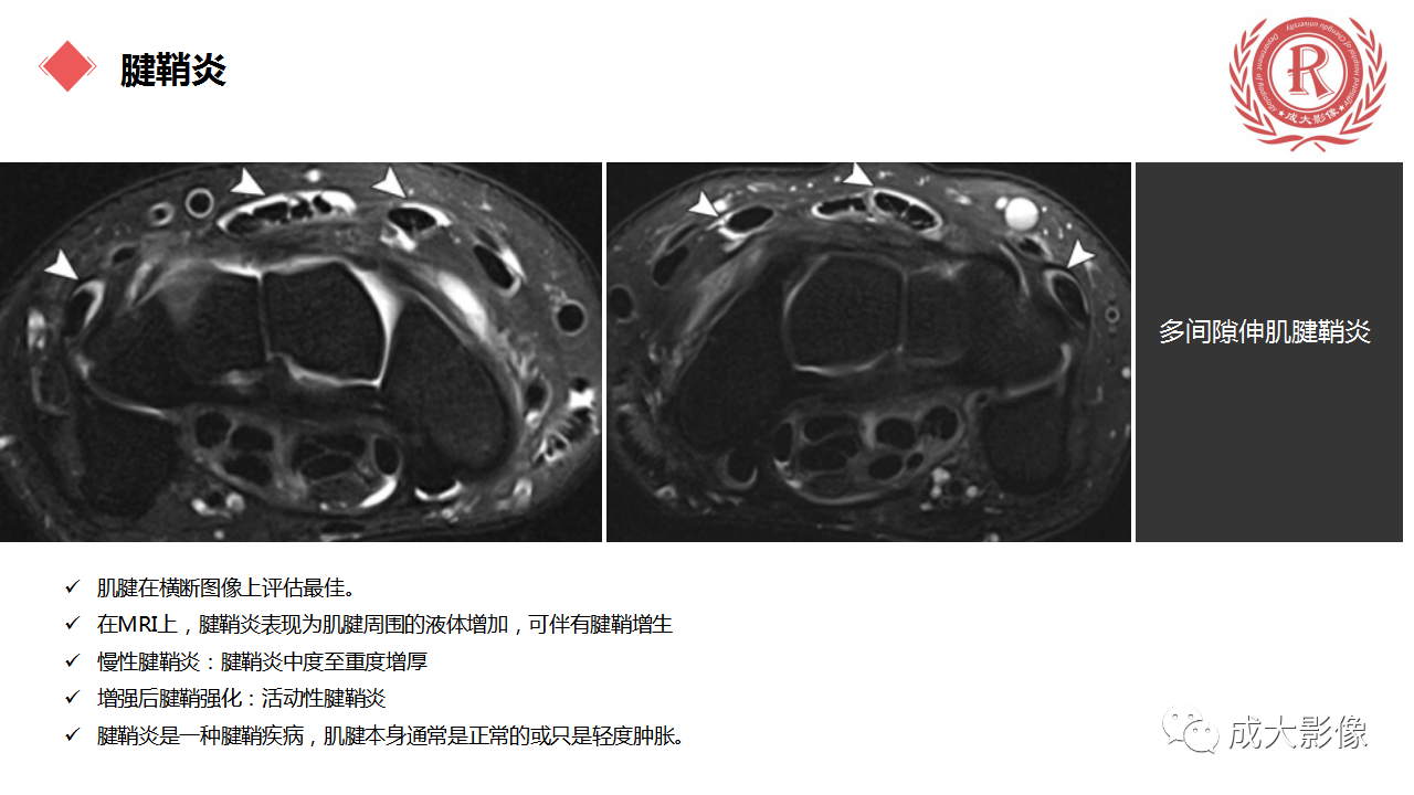 dfaf26981ddaf2aefef4d869a59a7ced.png